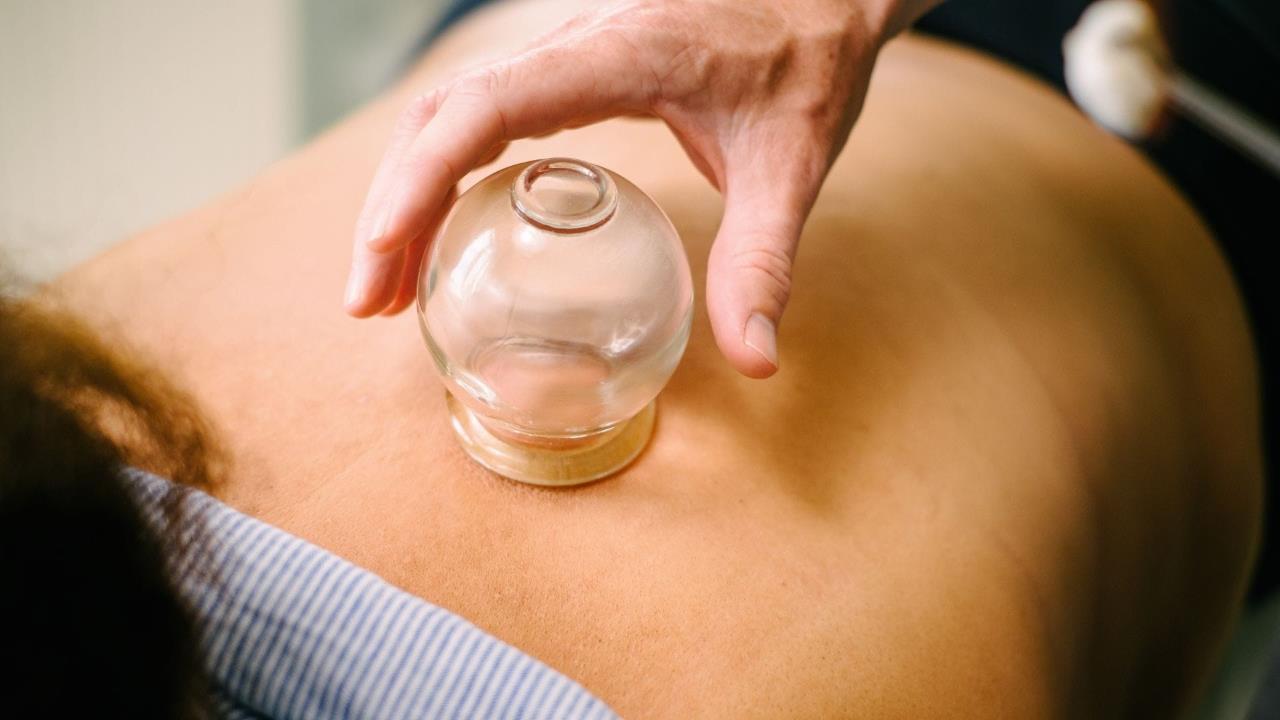 Close up of a patient receiving a cupping treatment on their back.